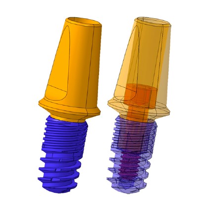 dental-cad-model