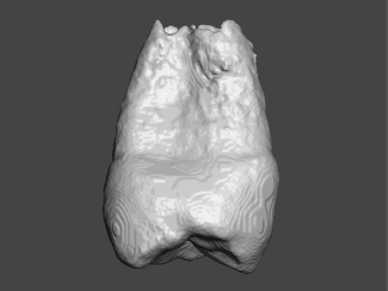 tooth-cad-model