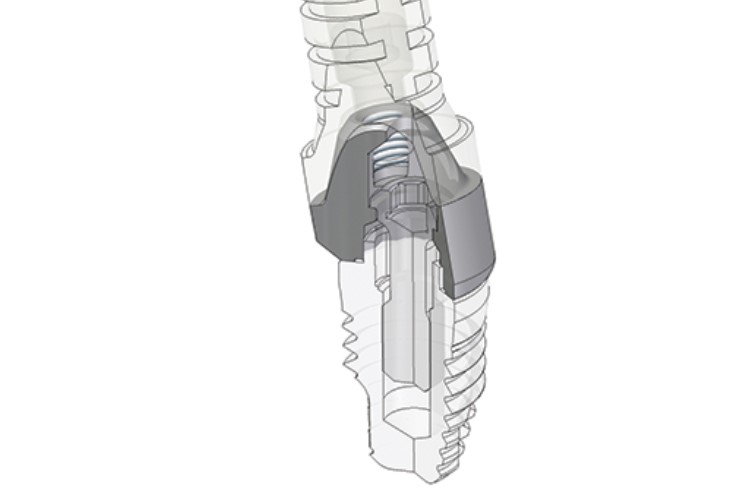 tooth-implant-cad-model